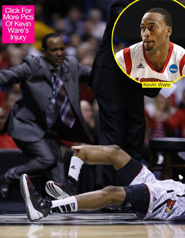 kevin-ware-leg-lead.jpg